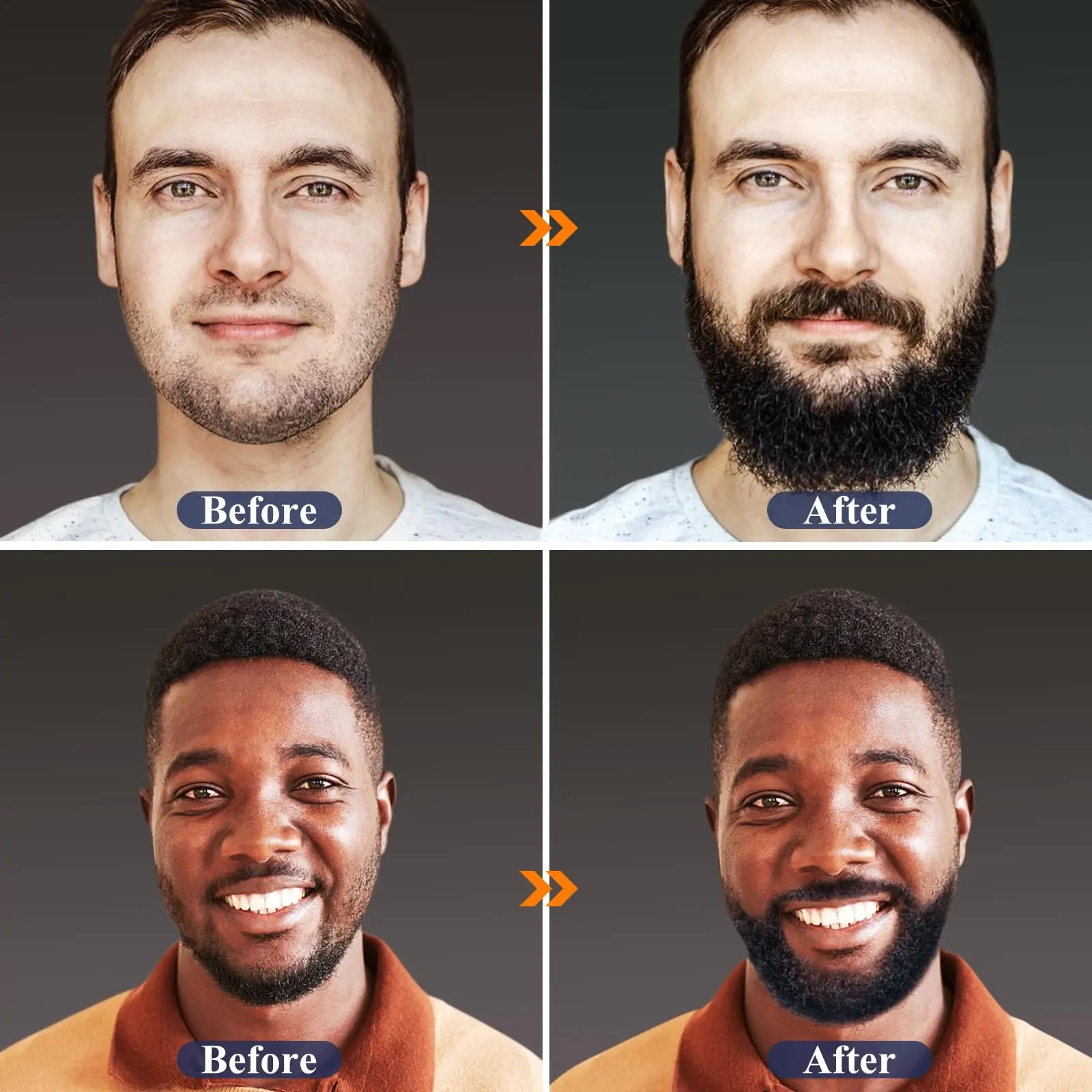 🧔: MALE GOD Beard Growth Kit - Complete Care System with Oil, Balm, Comb & Massager